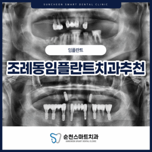 순천치과 임플란트 치료 전/후 대표 이미지