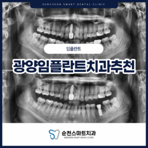 순천보철치료 치료 전/후 대표 이미지