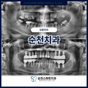 KakaoTalk_20260126_150641274