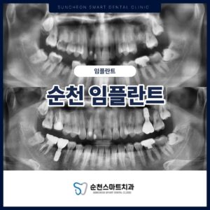 제목을 입력해주세요. (1)