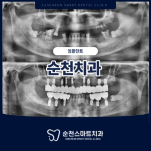 제목을 입력해주세요.