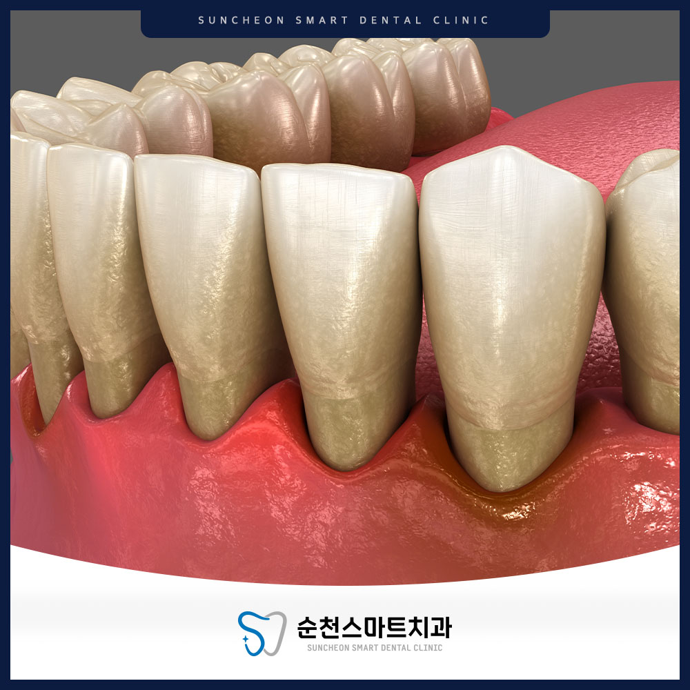 순천치과