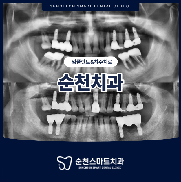 순천치과
