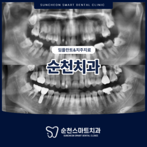 순천치과