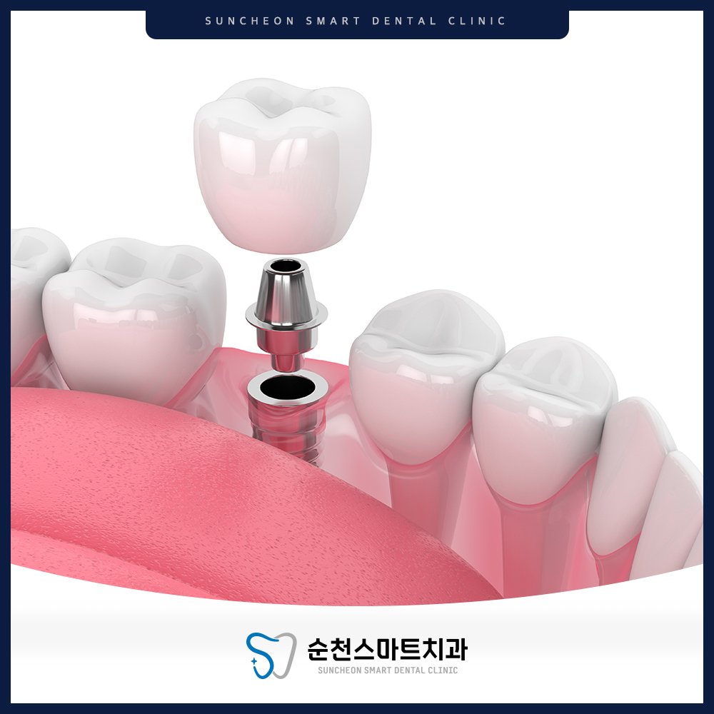 순천치과