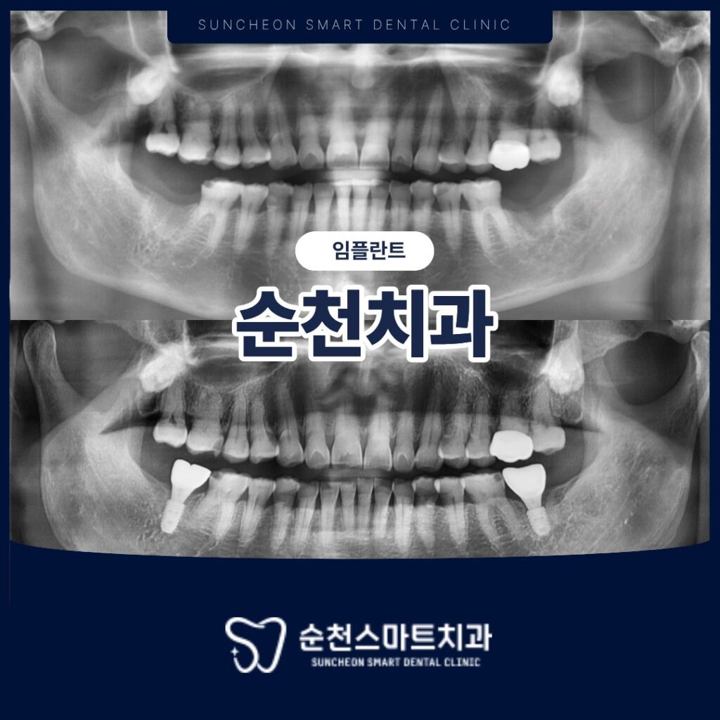 순천치과