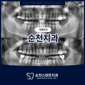순천치과