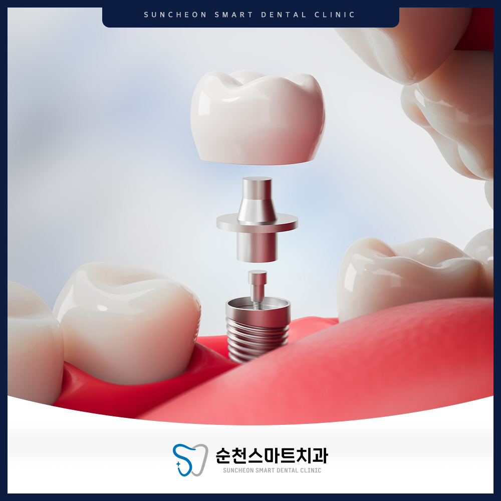 순천치과