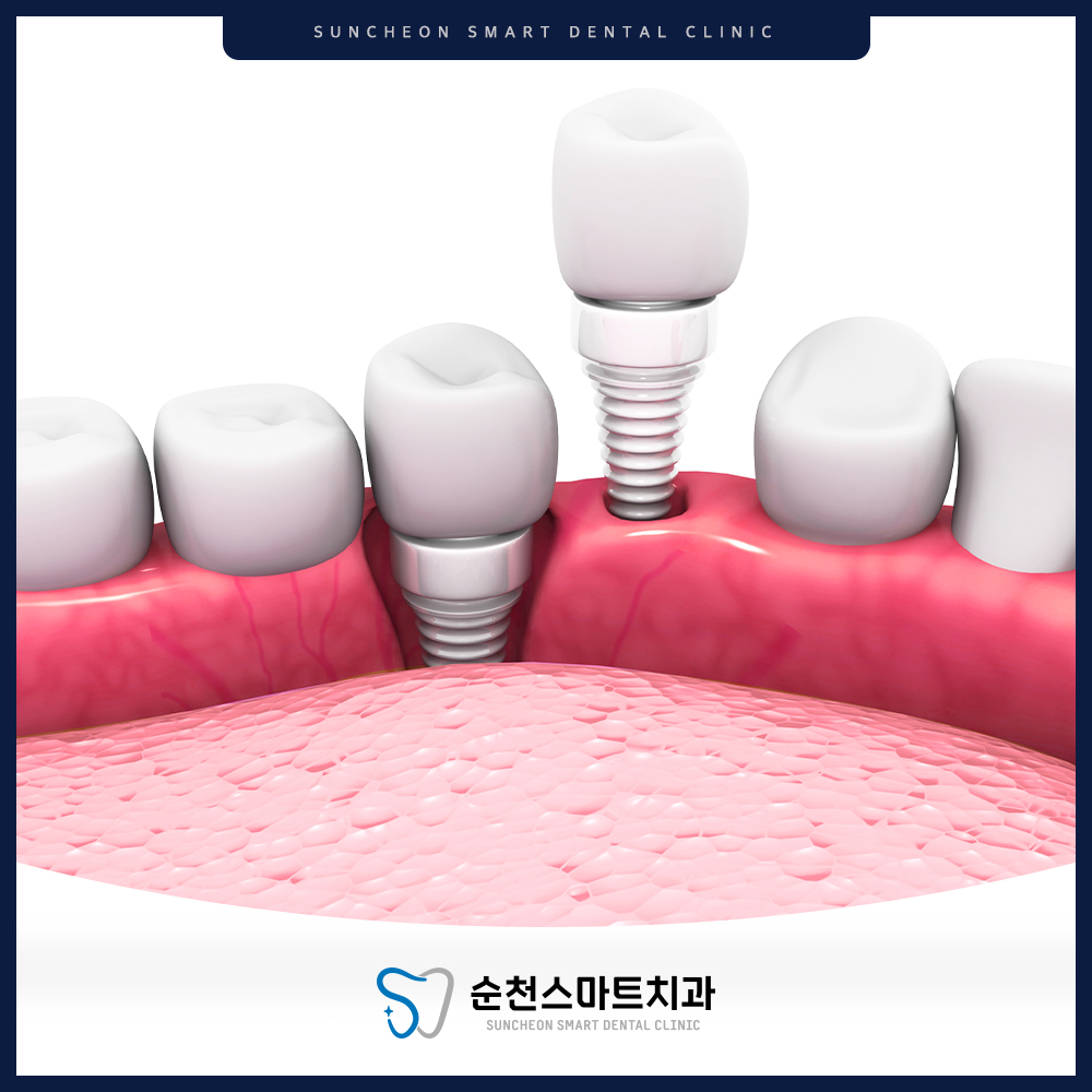 순천치과